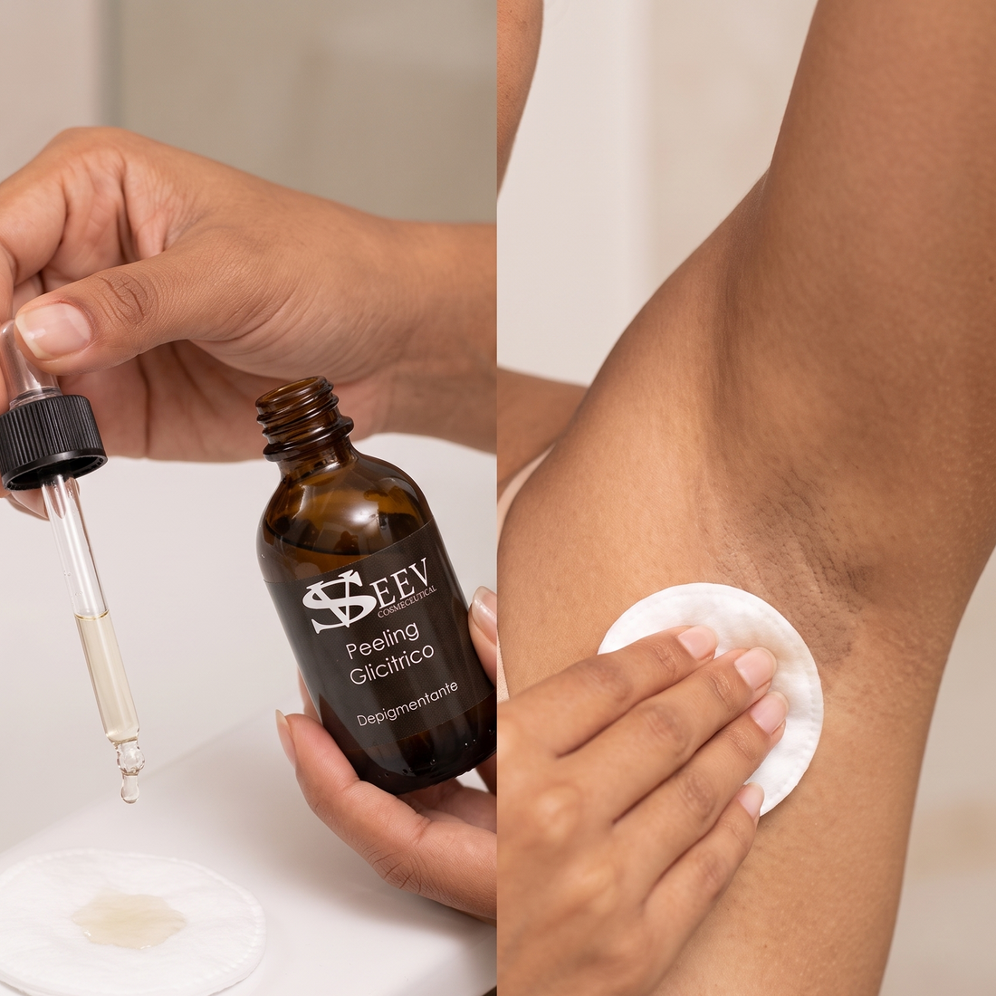 Chemical Peel for Dark Underarms: Does It Safely Work, or Is It Risky? 🤔