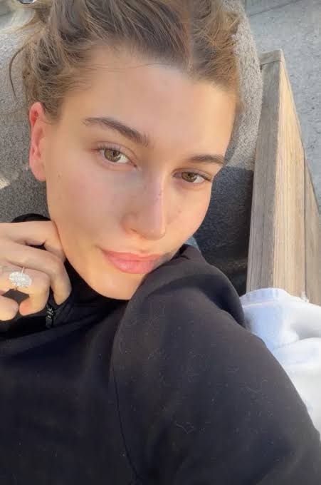 Hailey Bieber Loves Niacinamide: Skin Benefits Explained