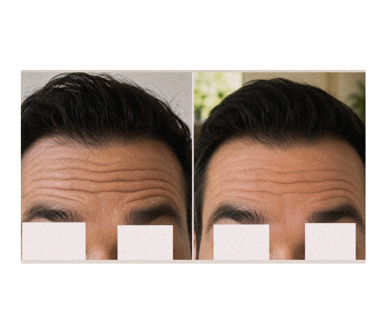 Anti Wrinkle Peptides Face Serum
